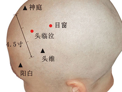 頭臨泣