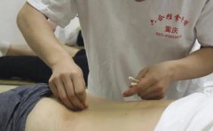 針灸初學者，你的持針手法正確嗎？