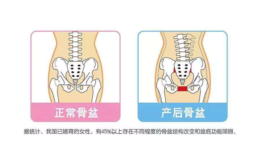重慶主城產后康復哪家培訓機構比較好？