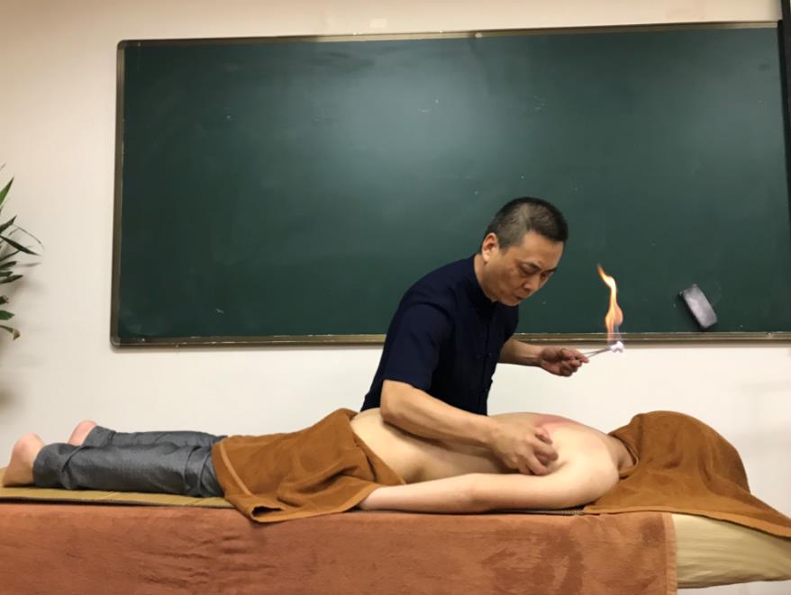 中醫可以通過拔罐辨別體質