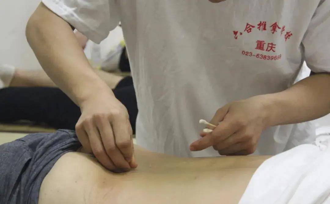 針灸真的很難嗎?一個(gè)月能學(xué)會(huì)針灸嗎?
