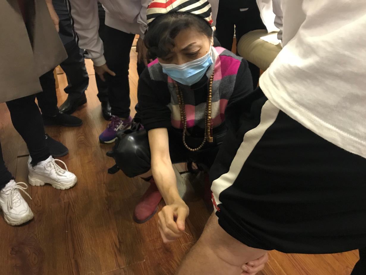 針灸怎么治療小腿酸痛浮腫？