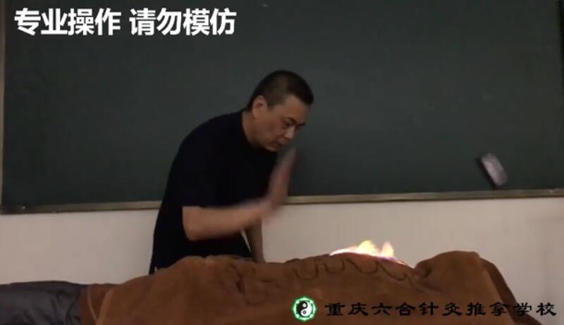 大家了解中醫火療嗎？其功效如何？