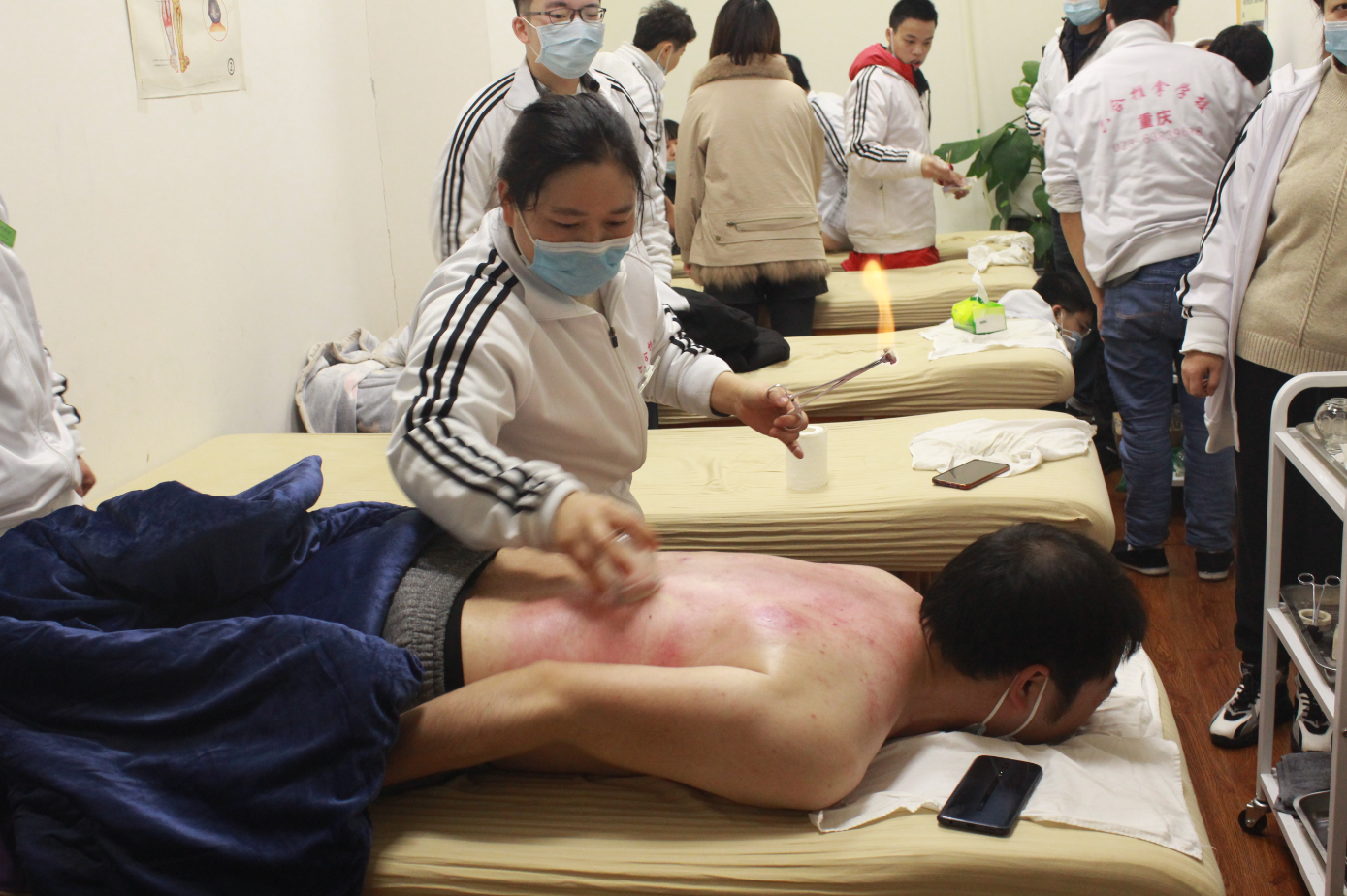 換季容易風濕腰痛 推拿拔罐效果不錯