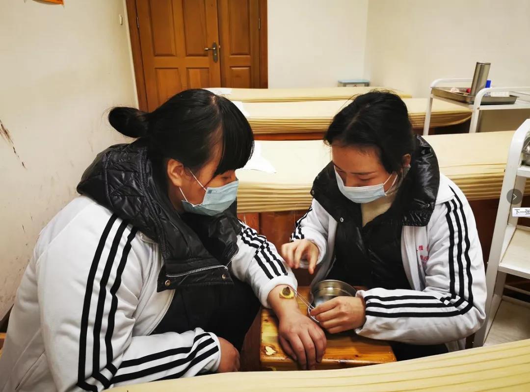 艾灸可以改善女性寒性體質