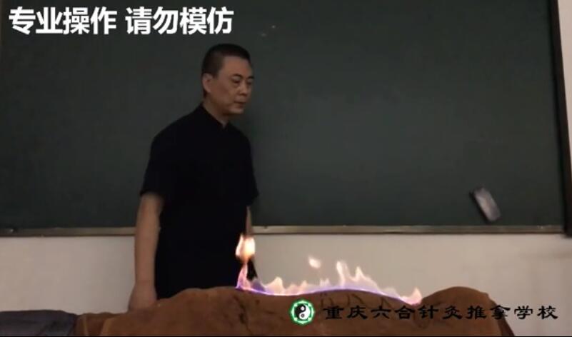 中醫火療可以起到強腎壯腰的作用