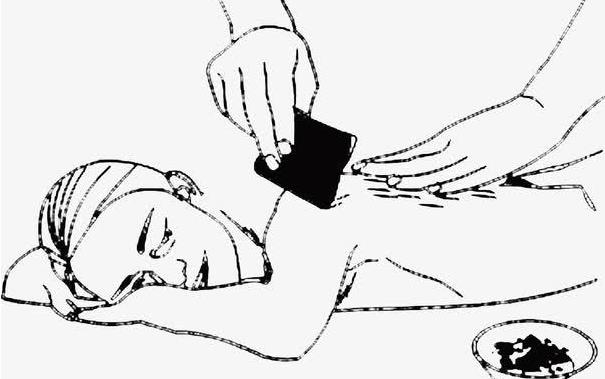 也許你不知道中醫刮痧有這些好處
