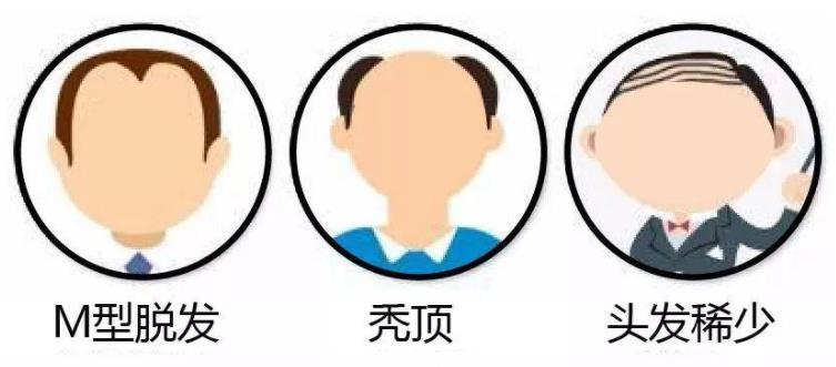 你有脫發困擾嗎？推拿按摩幫你治脫發